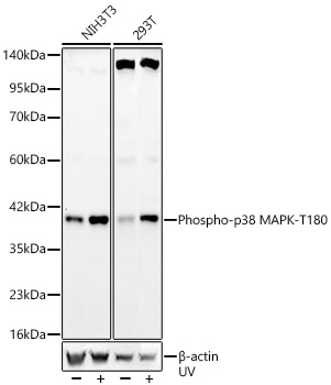 Phospho-p38 MAPK-T180 Rabbit mAb
