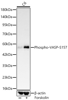 Phospho-VASP-S157 Rabbit mAb