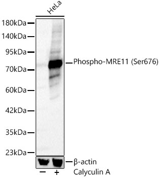 Phospho-MRE11 (Ser676) Rabbit pAb