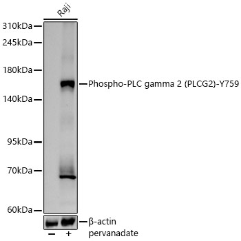 Phospho-PLC gamma 2 (PLCG2)-Y759 Rabbit mAb