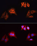 Immunofluorescence - Rhodamine (TRITC)-conjugated Goat anti-Rabbit IgG (H+L) (AS040)