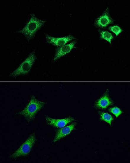 ABclonal:Immunofluorescence - ABflo® 488-conjugated Goat Anti-Rabbit IgG (H+L) (AS053)}