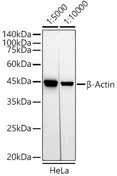 ABclonal:Western blot - HRP-conjugated  Mouse Anti-Rabbit IgG (H+L) (AS079)}